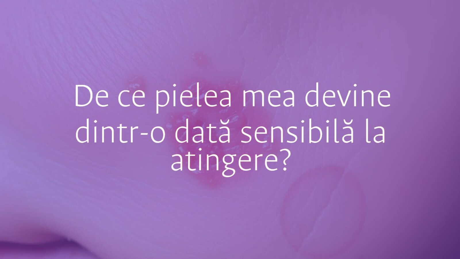 Close-up of sensitive human skin with redness and irritation, subtle dry patches, soft lighting, realistic.