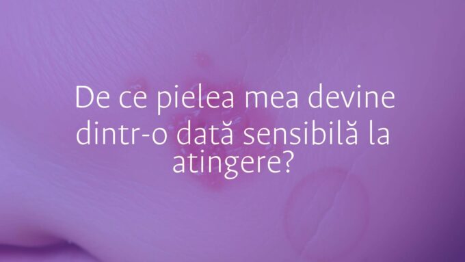 Close-up of sensitive human skin with redness and irritation, subtle dry patches, soft lighting, realistic.